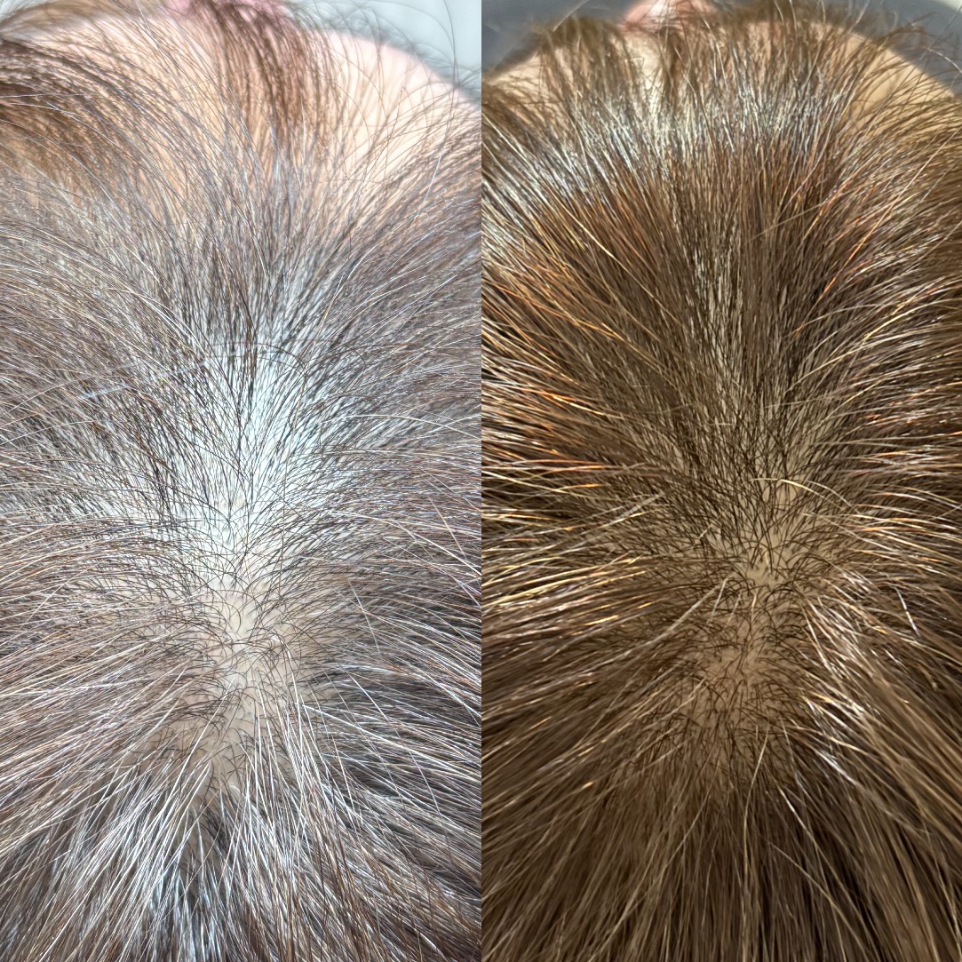 Before After 40代女性 分け目・ボリュームのお悩み